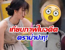 ซุปตาร์สาว งานเข้า! โดนอดีตเพื่อนสนิทเเฉประเด็นศัลยกรรม